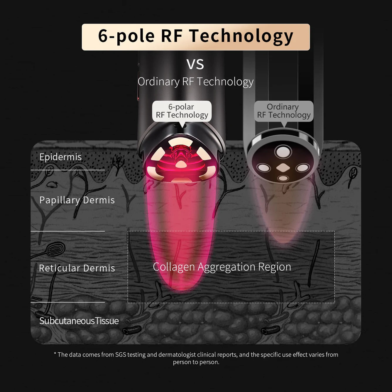 Face Lift Firming Rejuvenation RF Instrument with Backlight Pro Version