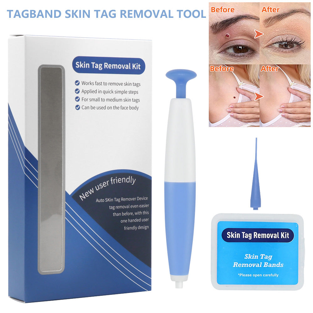 Skin Tag Removal Kit with Micro Bands – Safe, Painless Mole & Wart Remover for Home Use