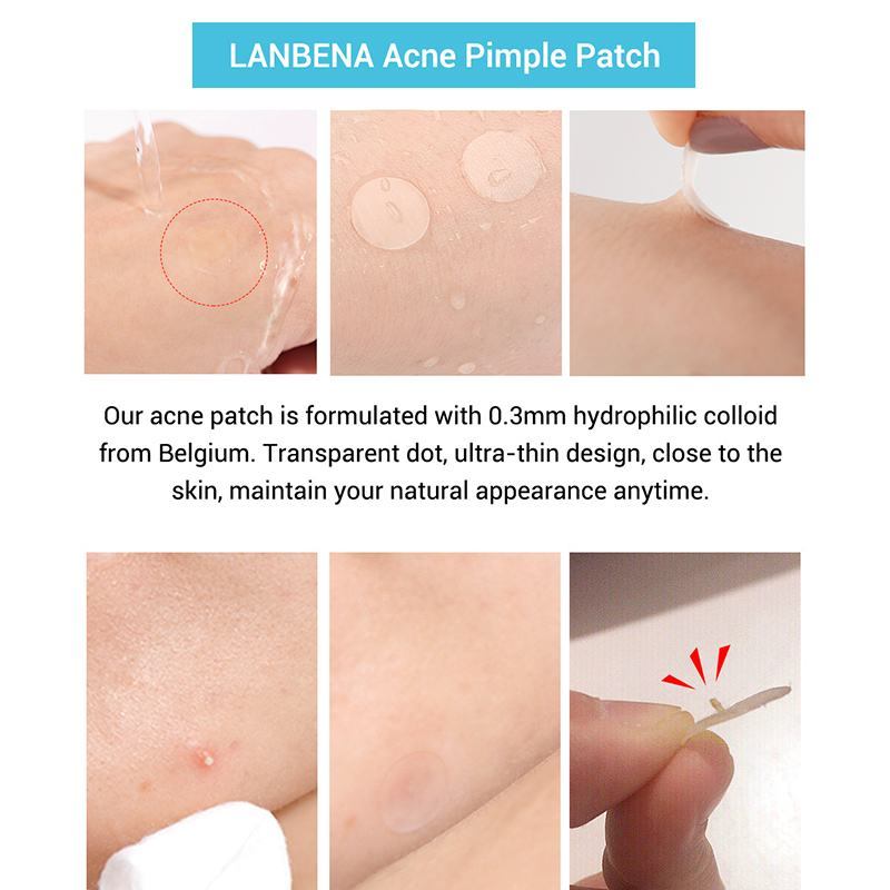 Acne Stickers with Tea Tree & Calendula Oil for Acne & Marks Fade