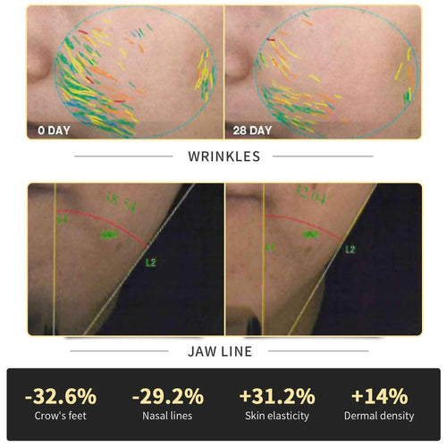 Face Lift Firming Rejuvenation RF Instrument with Backlight Pro Version