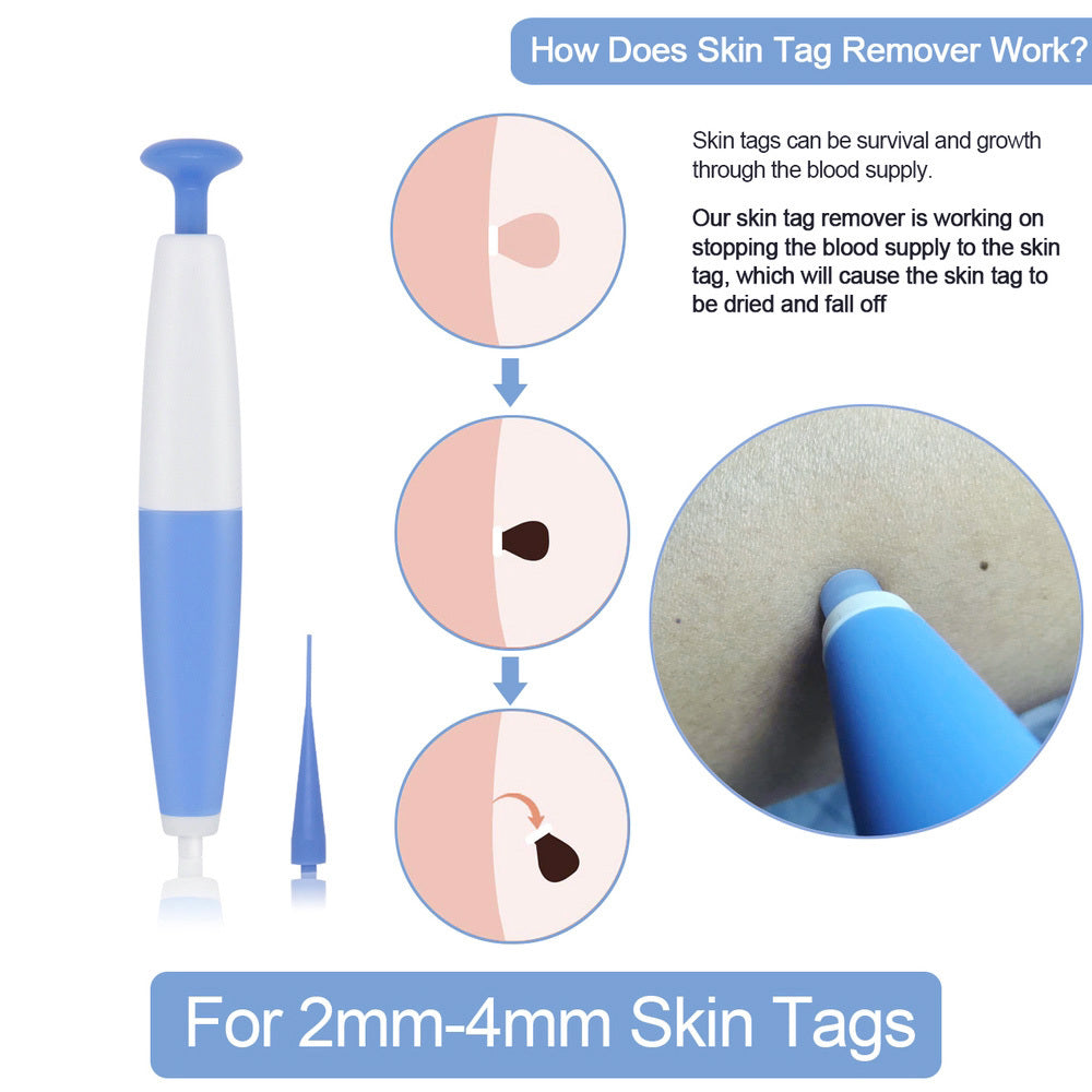 Skin Tag Removal Kit with Micro Bands – Safe, Painless Mole & Wart Remover for Home Use